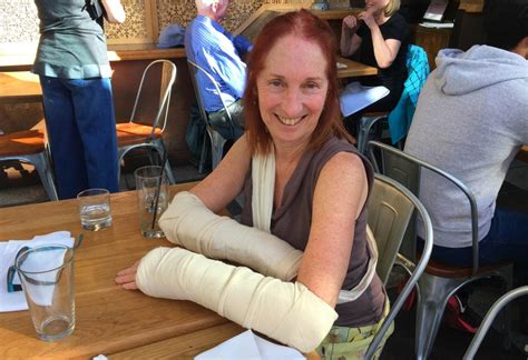wife broke her arm